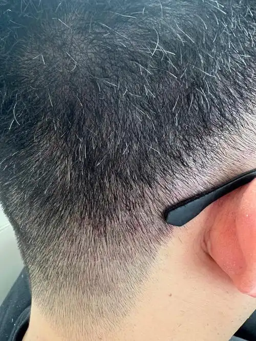 「gh头部健康生活馆」#解决所有头皮头发问题