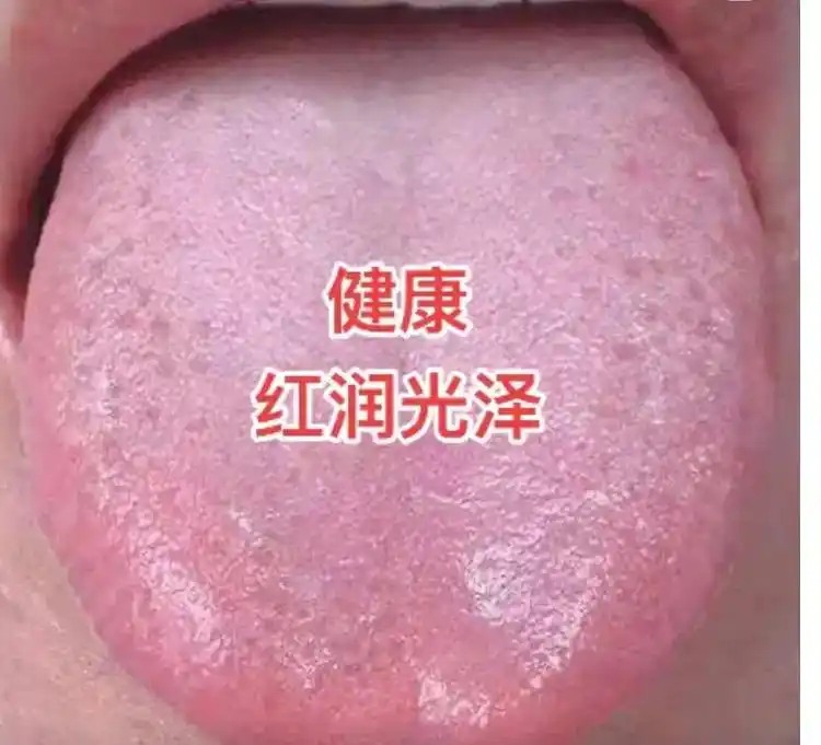 正常舌象的舌质荣润,舌色淡红,大小适中,舌体柔软灵活自如;舌 - 抖音