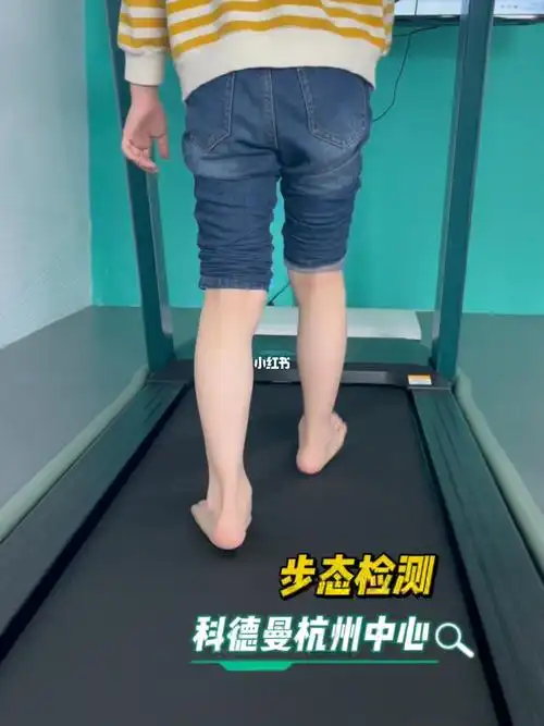 宝妈们有关注到孩子的走路姿势和腿型吗