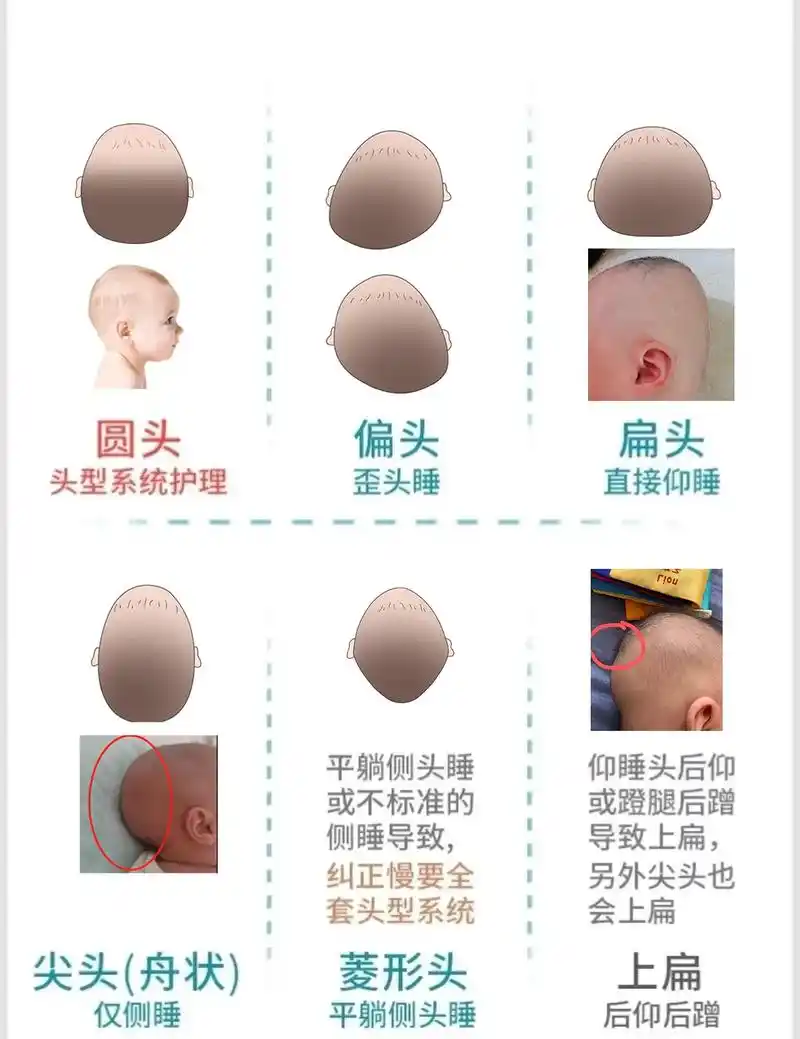 睡出漂亮小圆头~#宝宝头型 #睡头型 #育婴 - 抖音