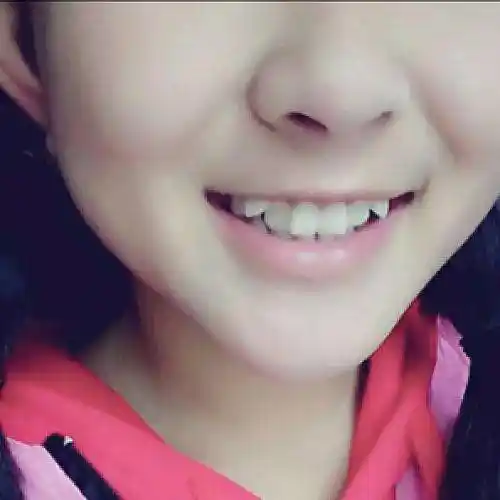 我的小孩上排牙齿有一颗虎牙应该怎么办才好