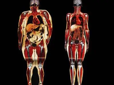 胸罩究竟是戴好还是不戴好,大便很臭不健康,芝麻酱最养生,肥胖如何 .