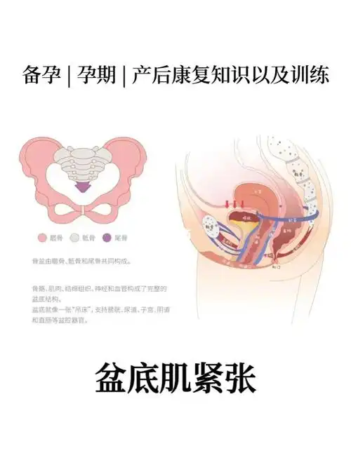 产康知识盆底肌除了松弛还会过度紧张60
