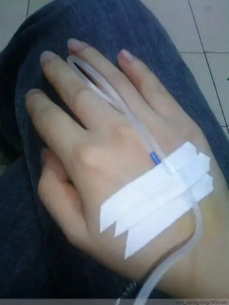 谁能帮我发一张输液的照片,女生的手,微胖一店手上不要带饰品谢谢