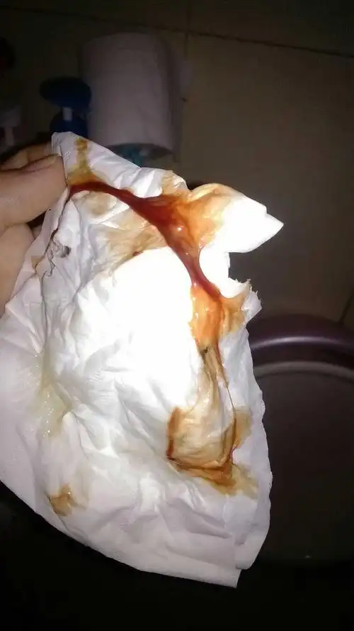 孕33周,这几天总流出带血的粘液,有同样的宝妈吗?是不是要快生了啊?