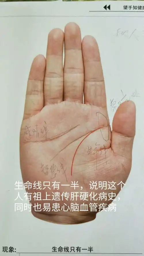 其它 夕阳红的美篇 写美篇1 性线延长线 2  生命线走一半断开 3手掌