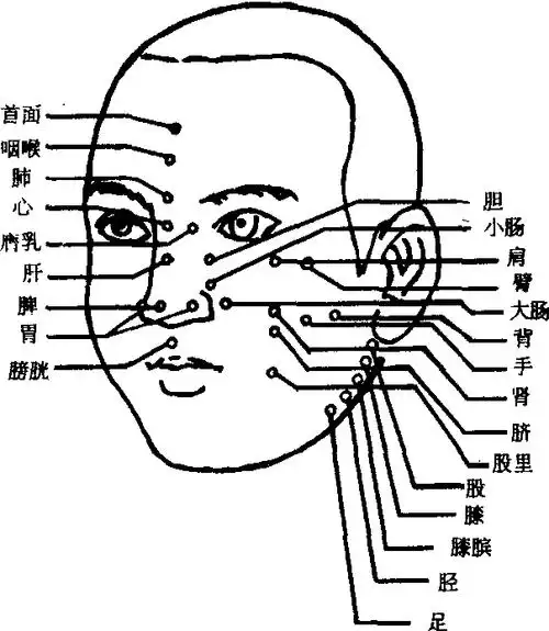 晋代皇甫谧的《针灸甲乙经》有针刺天容,颧髎,听宫,攒竹,承浆,人中,素