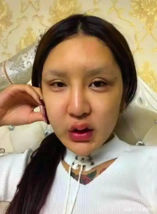 "花费近百万",三年动了60次的网红女孩现在咋样?简直判若两人