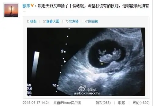 欧弟微博截图中新网6月17日电 今日,欧弟在微博晒出妻子怀孕的b超照