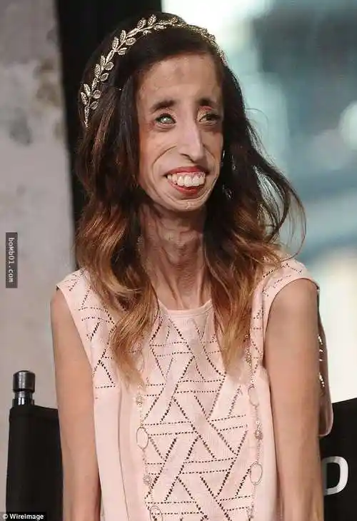 她曾被讥讽是「世界上最丑的女人」要她赶快自杀,结果面对这些霸凌她