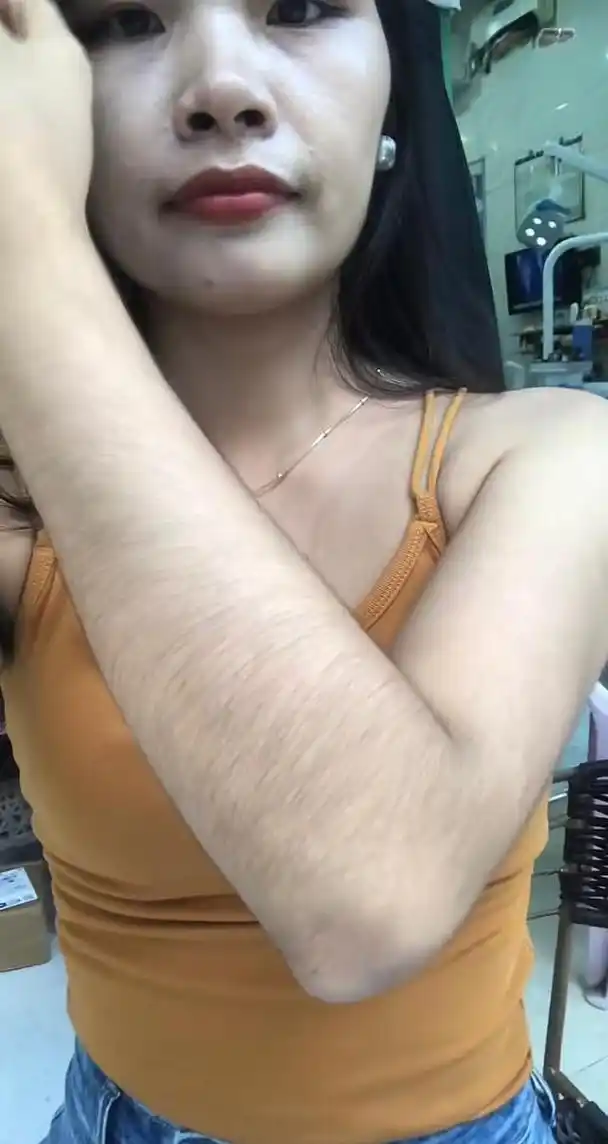 女生也因为汗毛太长自卑吗?