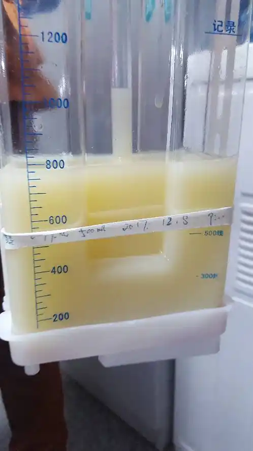 这样的胸腔积液颜色是淋巴瘤