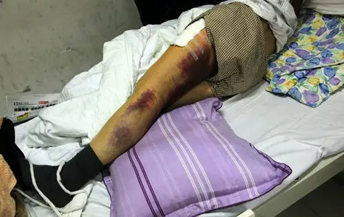 司法局副局长当街打科长续:警方称已构成轻伤害