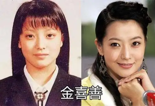 金喜善拿女儿老公说事奇葩回应整容传闻称不是自己的错