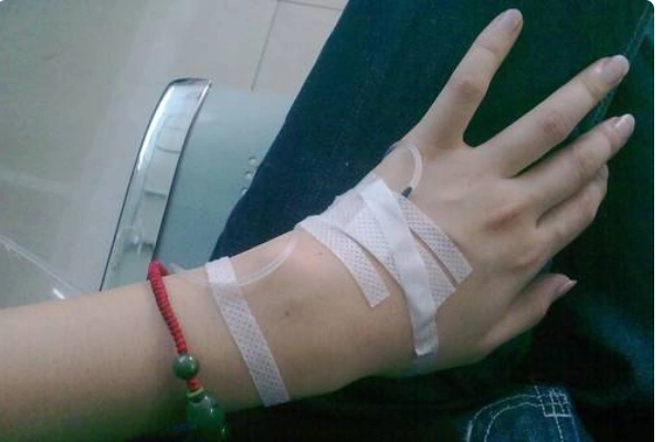 求一张女生输液的手部照片,谢谢啦!