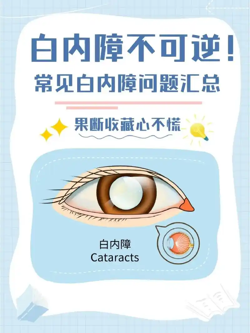 白内障不可逆!眼睛是心灵的窗口,是感知世界的视觉器官. 白 - 抖音