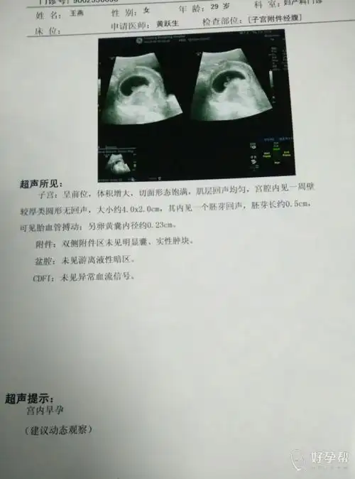 今天45天,去医院照了彩超,有懂得吗,一起来看看