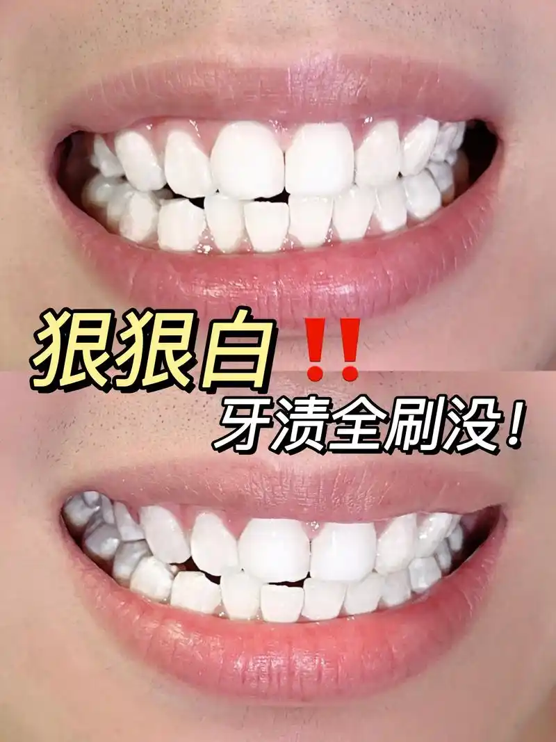 用这牙粉刷牙齿嘎嘎白!想白牙的兄弟看过来!
是不是