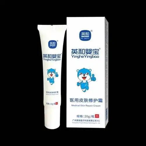 英和宝宝护肤怎么样 英和(yinghe)英和婴宝医用皮肤修护霜宝宝湿痒膏