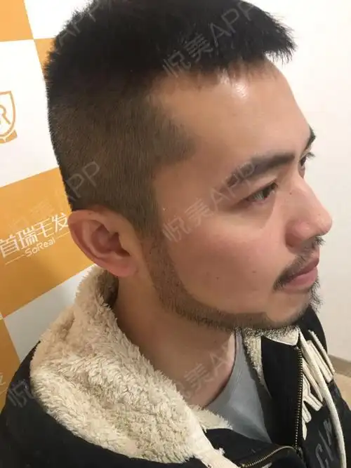 秃鬓角_秃鬓角留什么发型_女人秃鬓角适不适合留测分