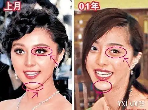 范冰冰整容前后对比 原来范冰冰也是人工美女