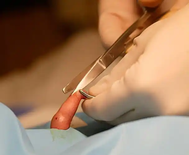 台中市包皮过长医院_台中市治疗包皮过长哪家医院好