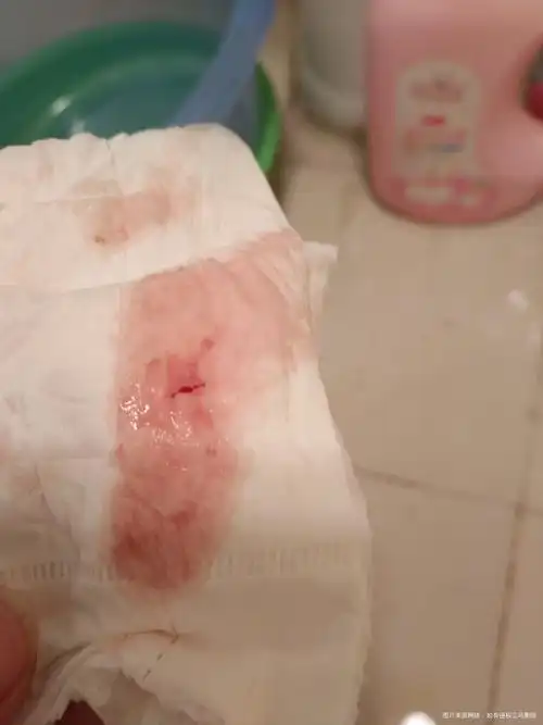 备孕期间排卵期出血正常吗