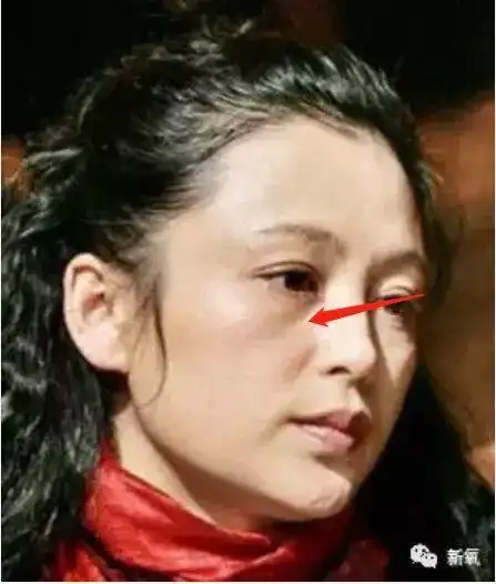 曾轰动一时的国民女神被拍到满脸横肉成大妈这脸还有救吗