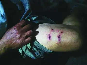 凶狗冲出地下车库咬伤4名路人 或具有獒犬血统