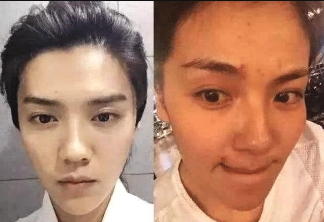 看看鹿晗卸过妆之后的照片,很多人都不敢相信自己的眼睛,因为满脸痘痘