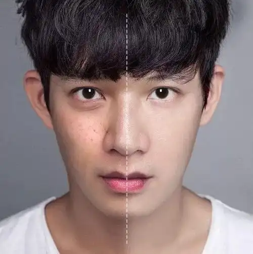 建议收藏皮肤暗黄是什么原因导致的呢