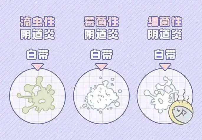 华克维两性霉素b阴道泡腾片轻松断炎~_女性_症状_疾病