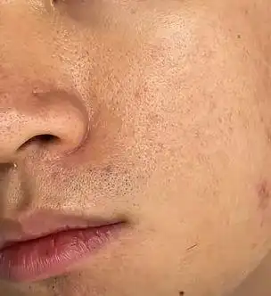 男生脸部皮肤又黑又糙,看起来没精神,要用什么护肤品?