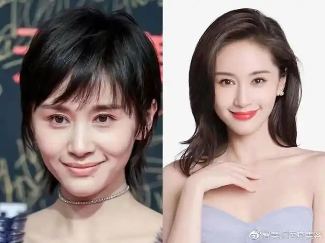 智美汇苹果肌下垂显老治疗方式有哪些