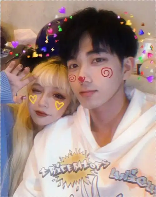 网红机智张关掉磨皮纯素颜出镜,脸上毫无瑕疵,妆前清