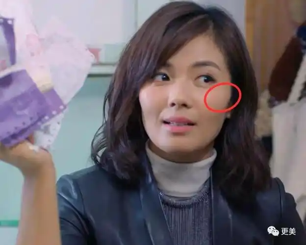 额头窄颧弓高图片