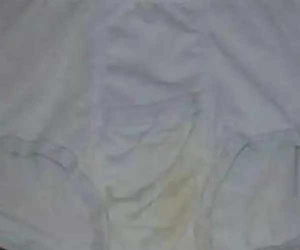 孕期变化很大,若内裤变黄,可能和这些原因有关