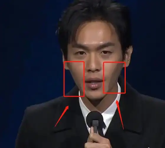 张若昀双颊凹陷气色差瘦到脱相还是蹭月子餐胖了十斤的他吗