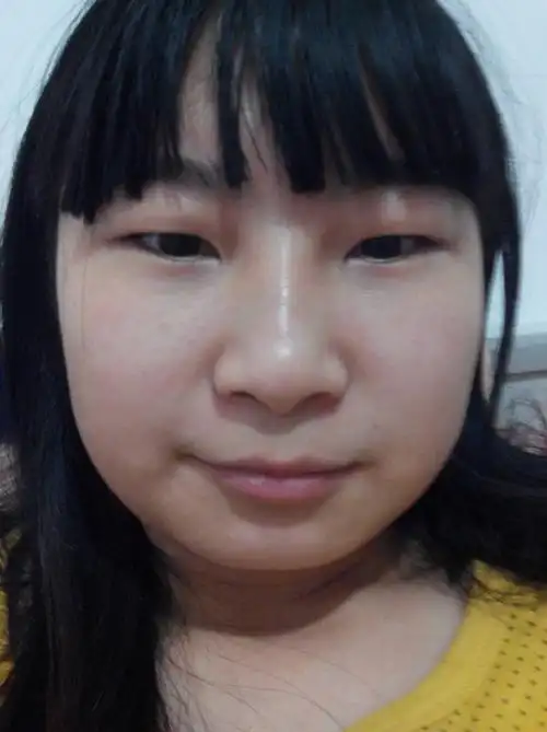 新浪微博 qq空间  浏览 44 次 5个回答  展开全部 标准的国字脸   本