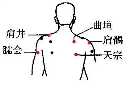 肩周炎治疗穴位图