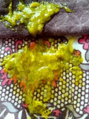 你好,宝宝拉绿色粘液稀便,大便化验有脂肪球,只是消化不良引起的吗,要