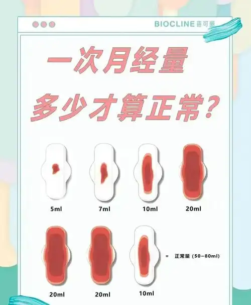 量～2包以内卫生巾26615月经过少≤5ml~1个瓶盖血量～1包以内卫生