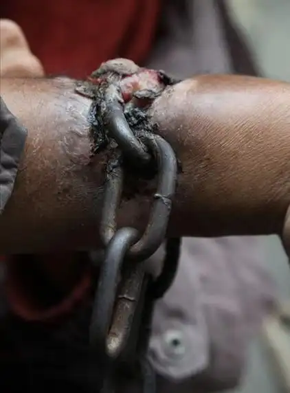 青年男子手脚都被锁上铁链的事实背后,肯定有很多辛酸的故事,敬请