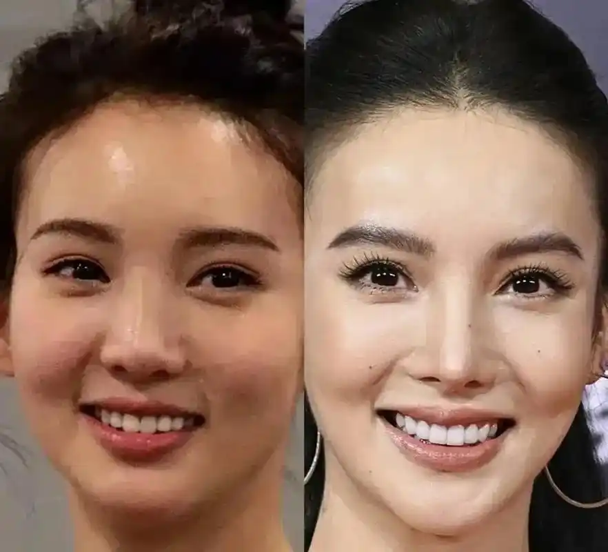 早期的金晨蛮好看的,现在真的很不自然