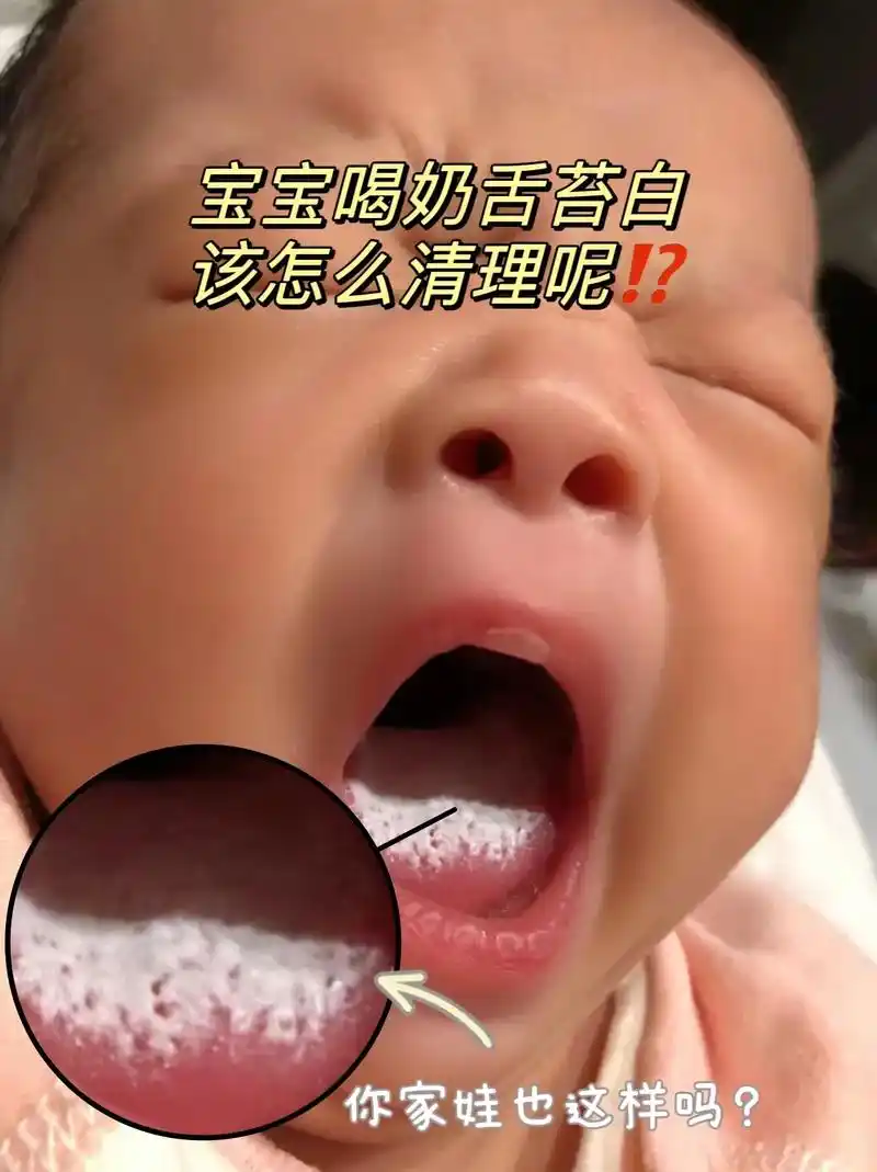 你家宝宝也这样吗⁉️