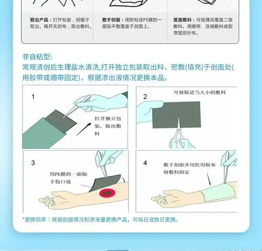 6s功能性敷料原银离子抗菌功能性敷料修复糖尿病足烧烫伤褥疮压疮溃疡