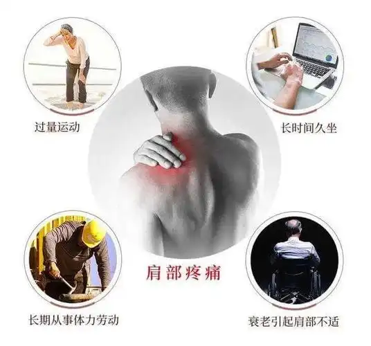 肩周炎如何分期症状是什么