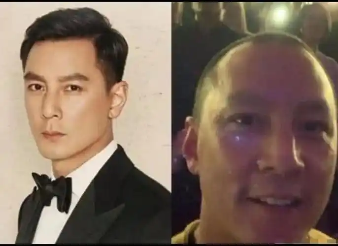 原创吴彦祖秃头真成为苏大强!近照明显脱发,发际线后移脑门堪比陈奕迅