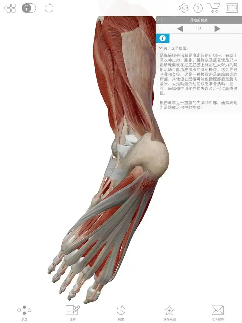 体育生 #运动解剖 #足底筋膜炎 运动量体重大特别是soa - 抖音