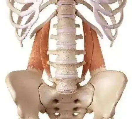 第三腰椎横突综合征